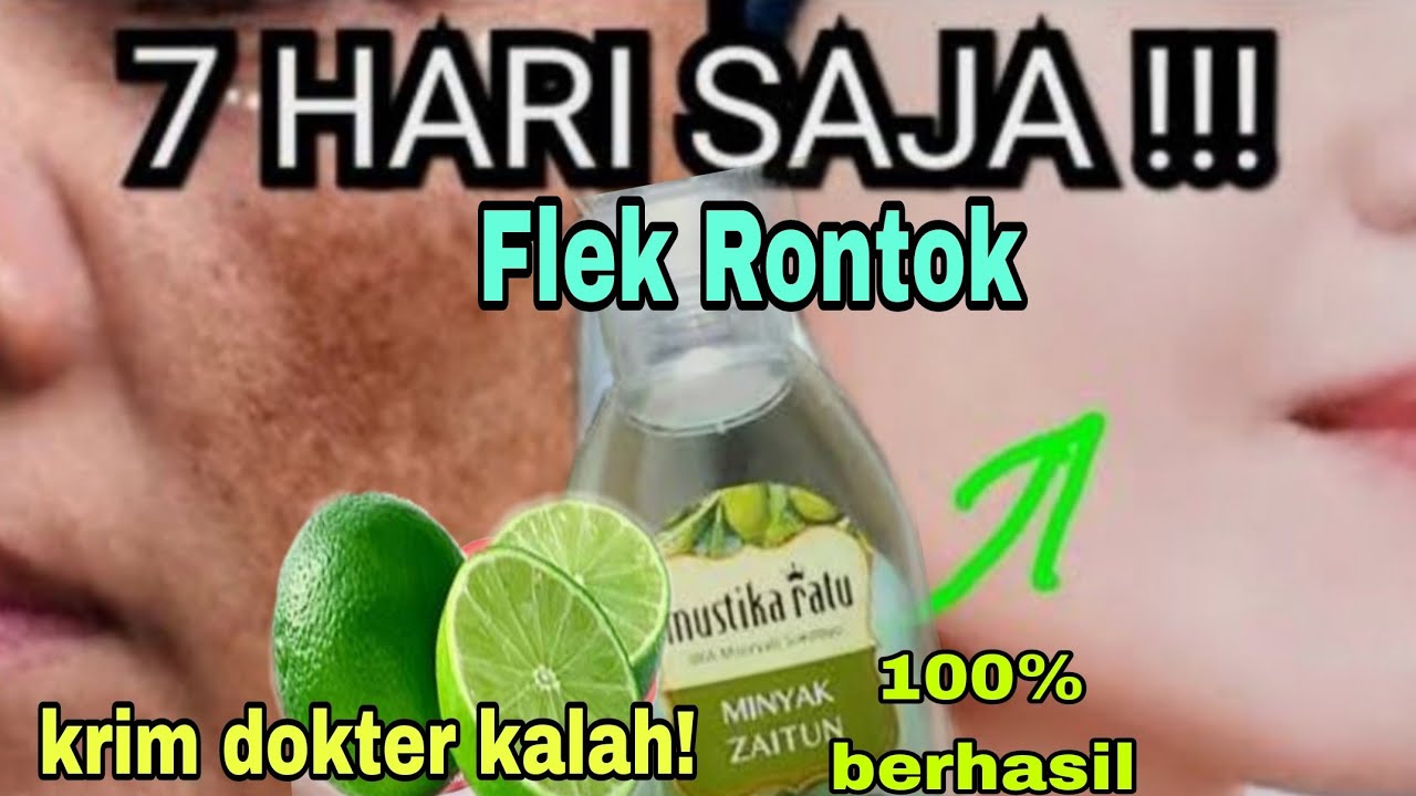 FLEKHITAM RONTOK DALAM 7HARI DGN JERUKNIPIS DAN OLIVE OIL/Rewiew