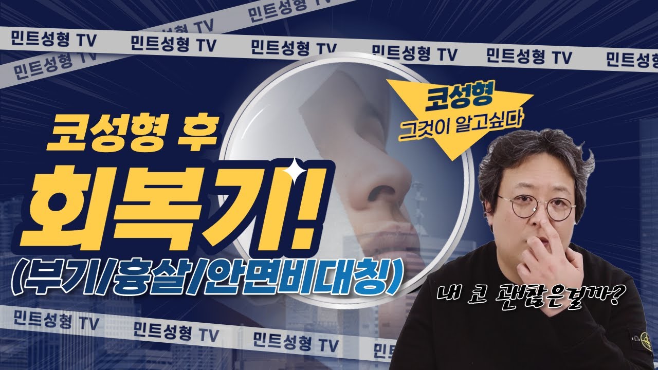 코성형후 코가 이상해요!!!정말 부기 ✔ 흉살✔ 안면비대칭 때문인가요?(feat.코성형후 회복기)