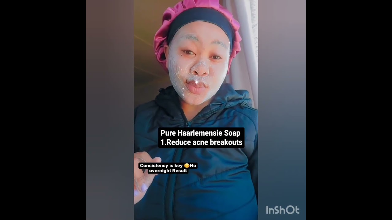 pure haarlemensie soap and vaseline haarlemensie dark spot remover