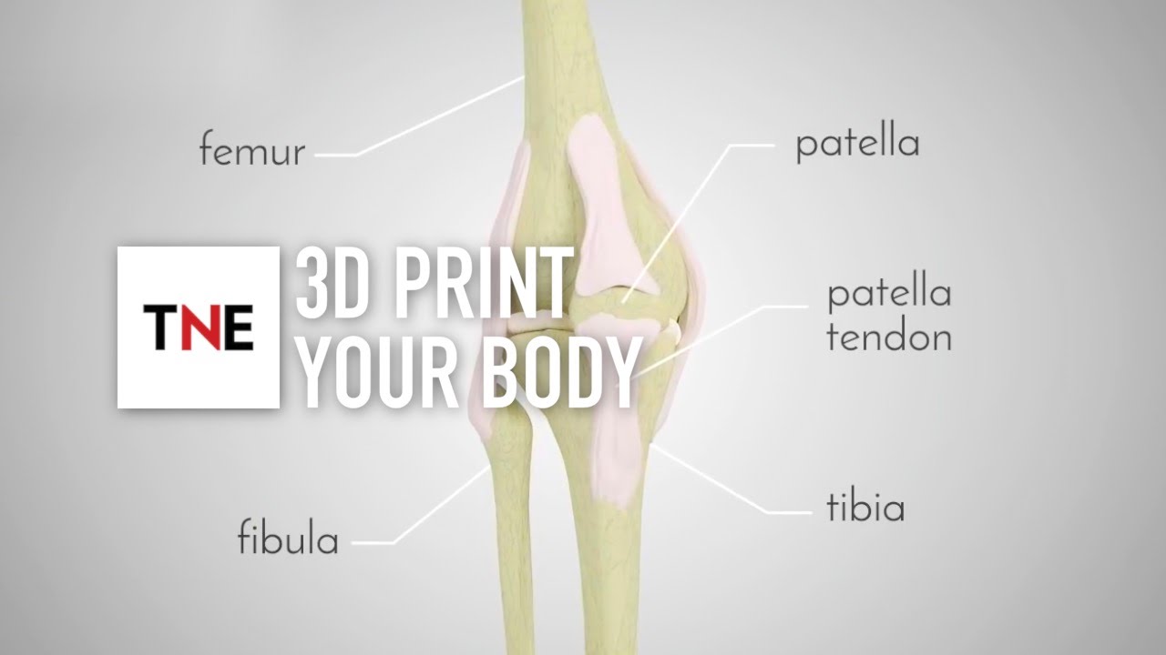 Replacing body parts with 3D printing: how one company is bringing hope to patients across the globe