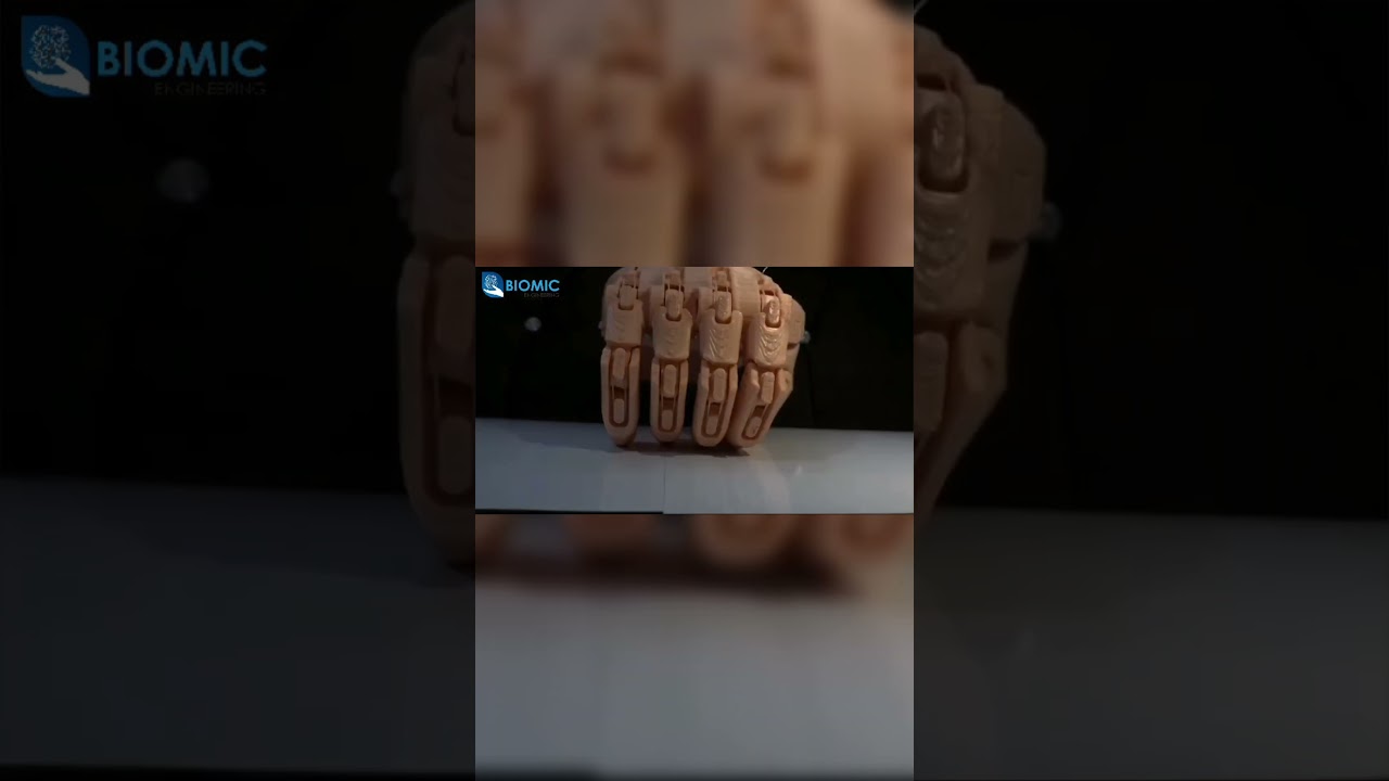 Biomic Hand v0 #partialhandprosthesis  #artificialhand #prostheticdesign #hope #lifechanging #robot