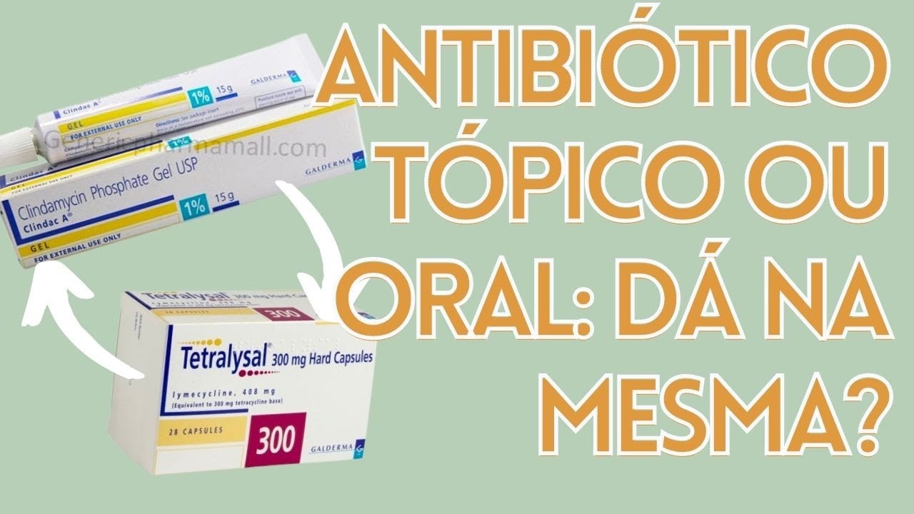 Tudo sobre Antibióticos para Acne