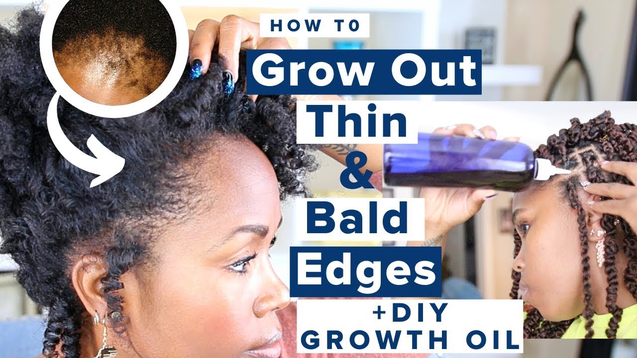 8 Ways to Grow Thin & Bald Edges On Natural Hair FAST | Tips for Hair Loss & Growth + DIY GROWTH OIL