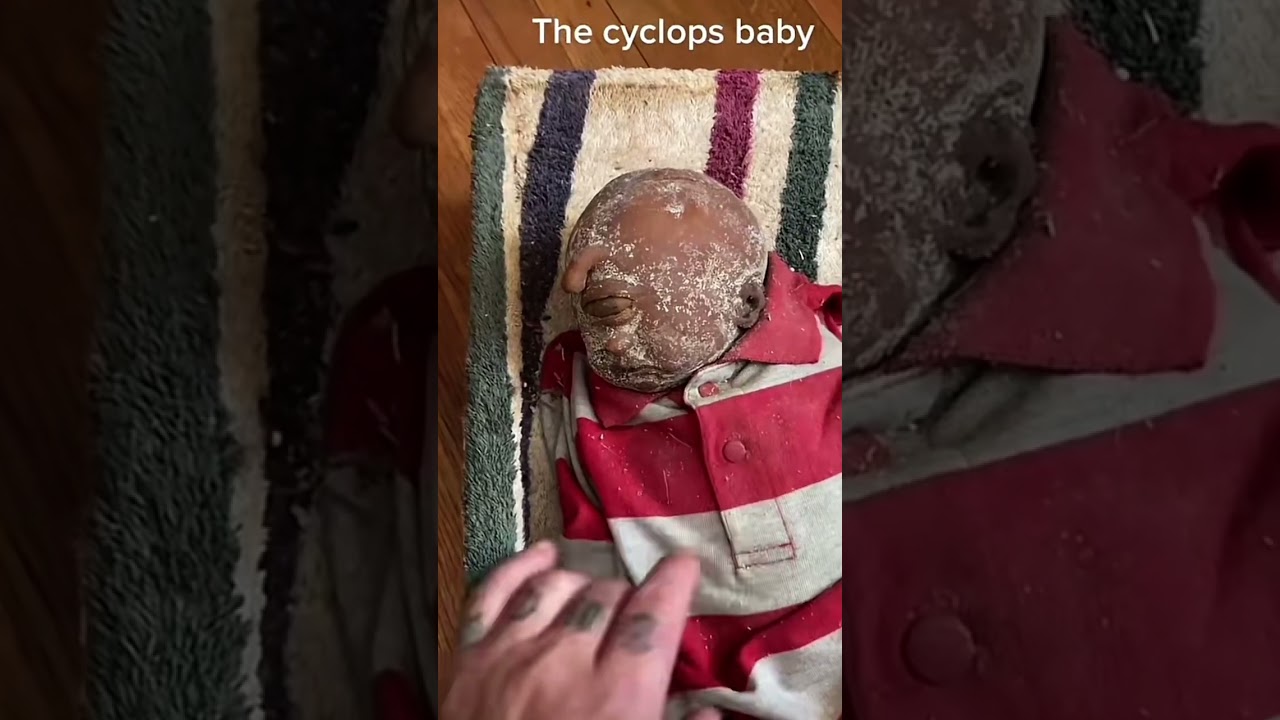 #wow Amazing #Cyclops Baby# Never Seen Before #