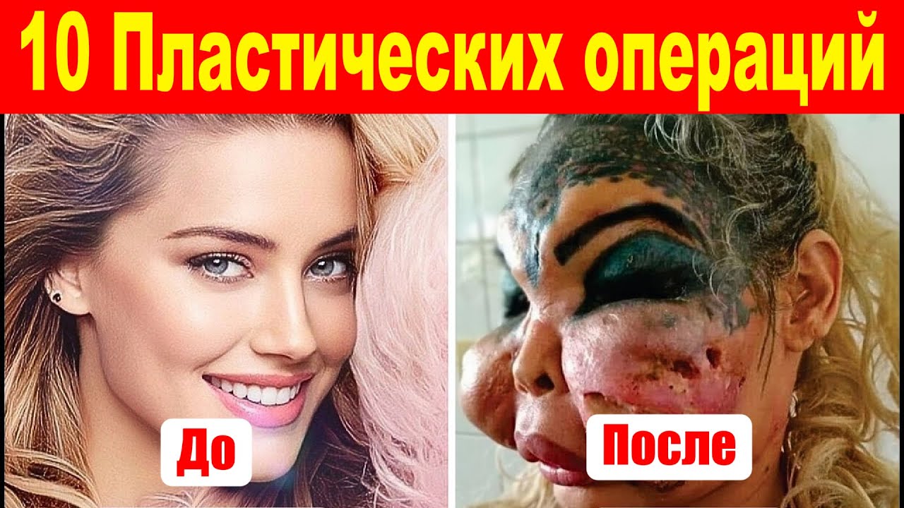 Топ 10: Шокирующие преображения знаменитостей! Кто изменил лицо до неузнаваемости?