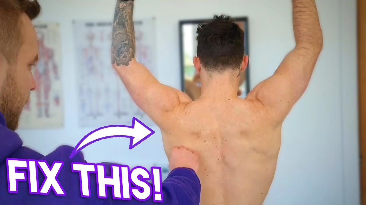 Scapulohumeral Rhythm 🎶🎶🎶🎶 | Winged Scapula Treatment