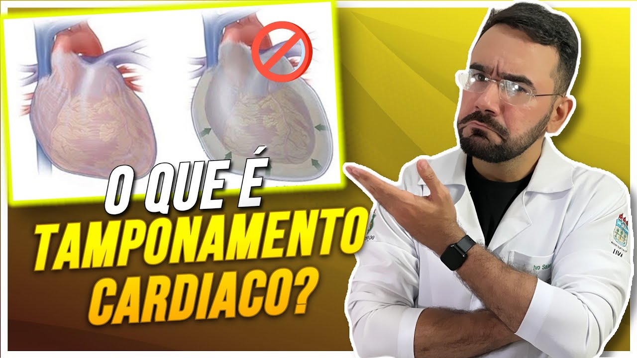 TAMPONAMENTO CARDIACO: O QUE VOCÊ PRECISA SABER? (TRÍADE DE BECK)