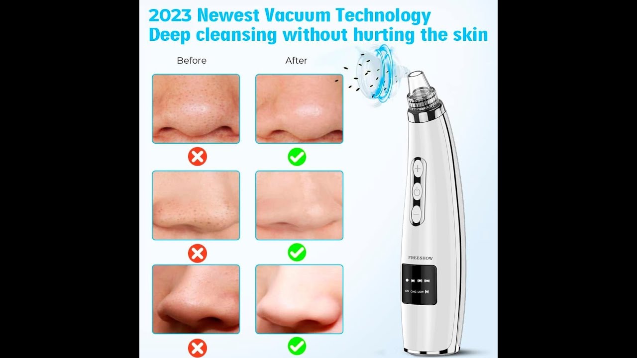 the best Blackhead Remover Pore Vacuum,Upgraded
