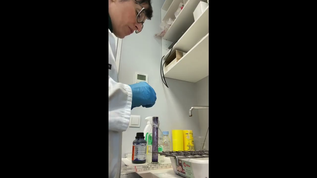 Biodosimetría: preparación tinción SCE (Sister Chromatid Exchange) (Vídeo 7)