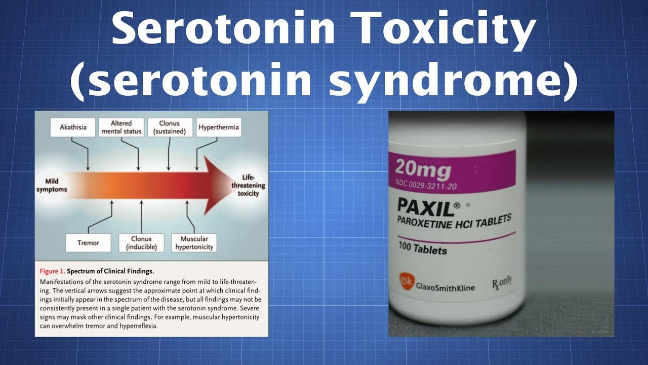 Overdosing on Serotonin: What to Know About Serotonin Toxicity