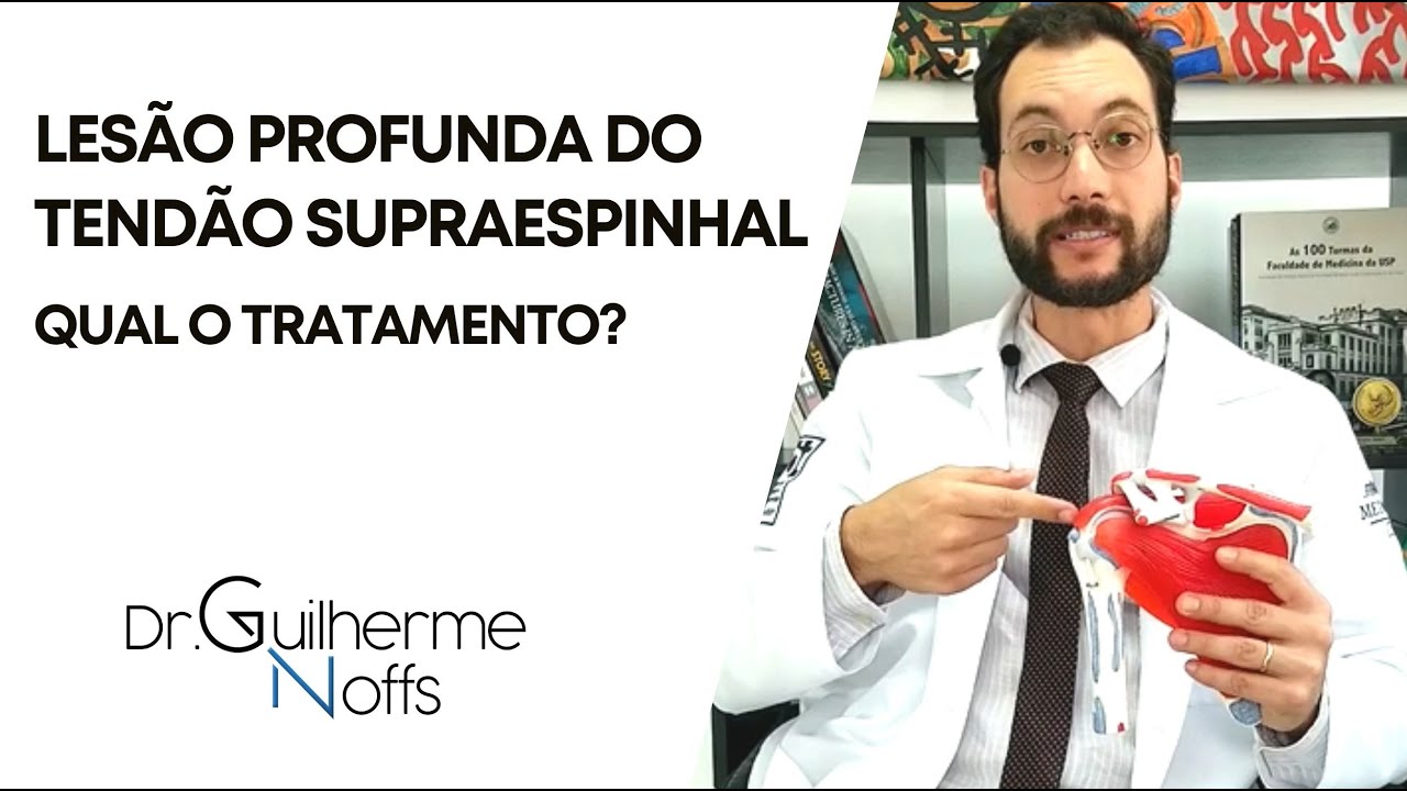 Tratamento da les&atilde;o profunda do tend&atilde;o supraespinhal - Dr Guilherme Noffs