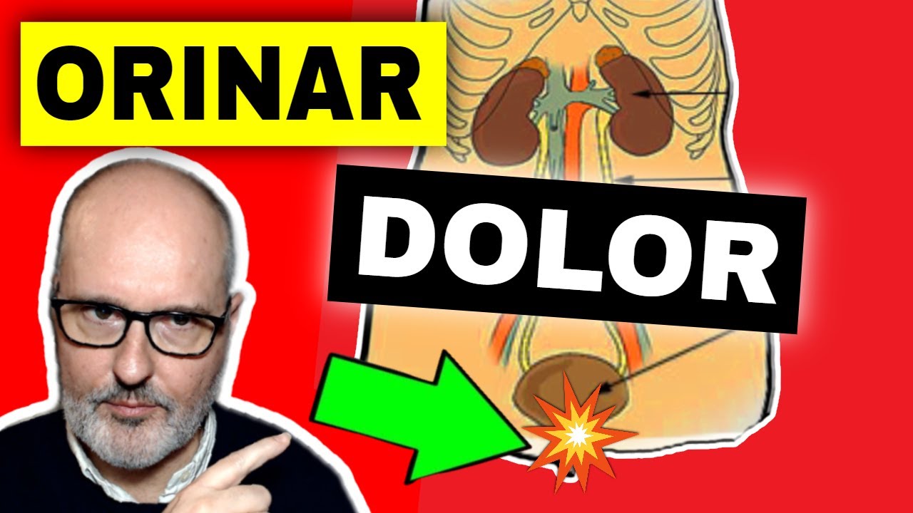 CAUSAS de ARDOR y DOLOR al orinar y Tratamientos (MICCI&Oacute;N DOLOROSA)