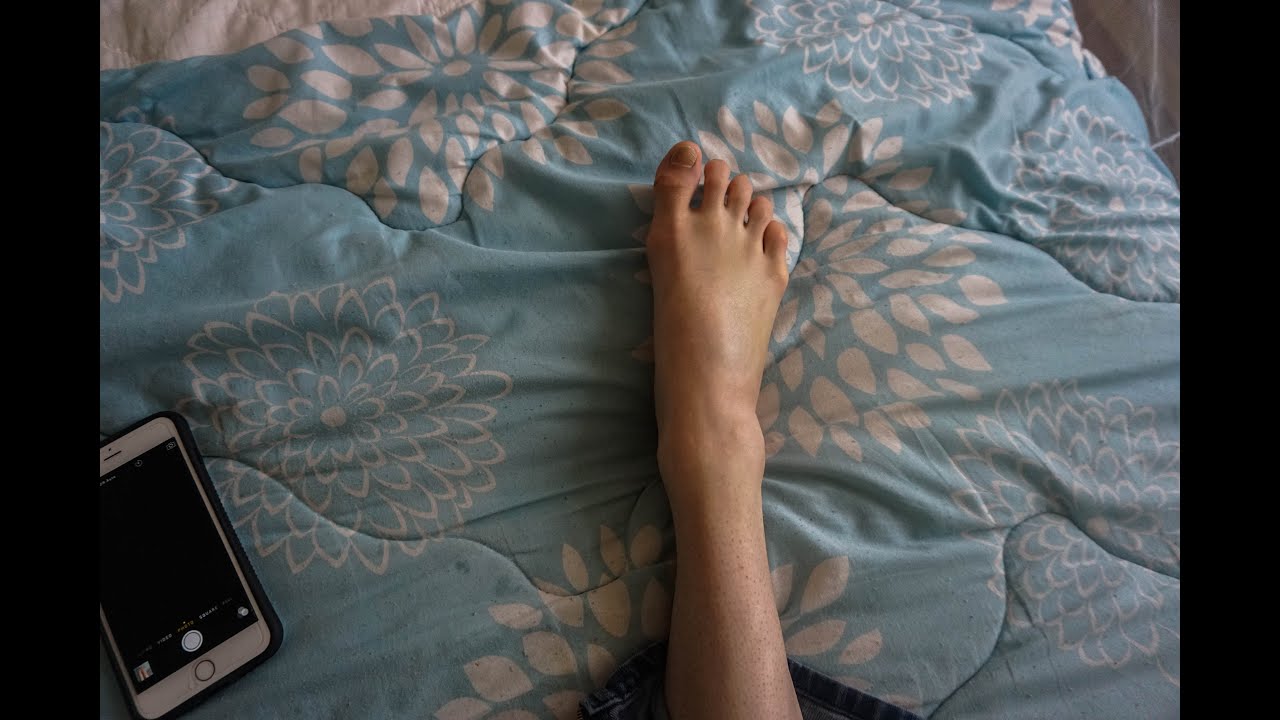 What Getting Injured Looks Like