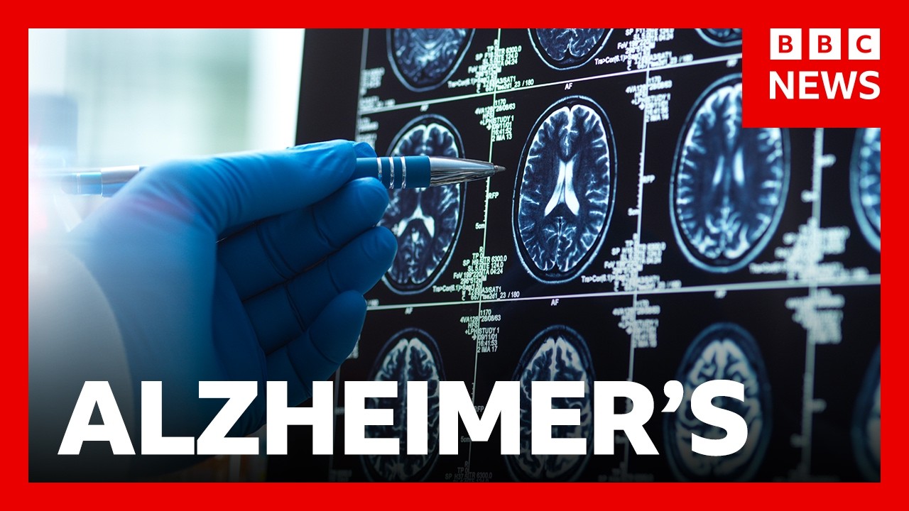 'Breakthrough' Alzheimer's drugs unlikely to benefit patients, report suggests | BBC News
