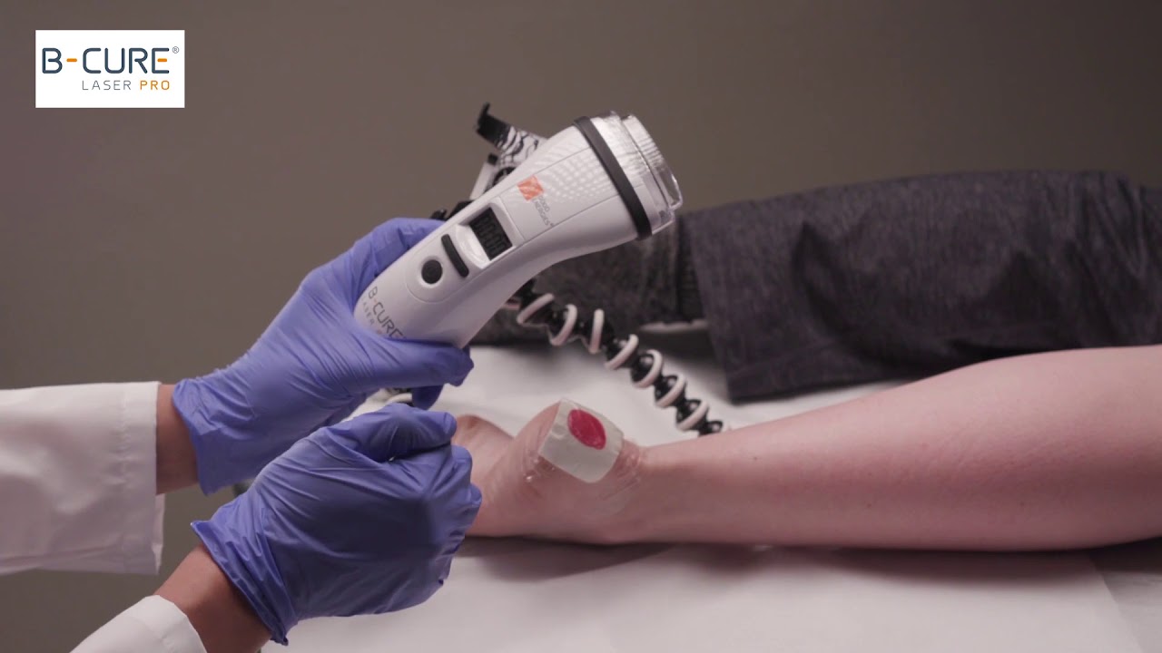 B-Cure Laser PRO : Treatment of Pressure Ulcers / Bedsores