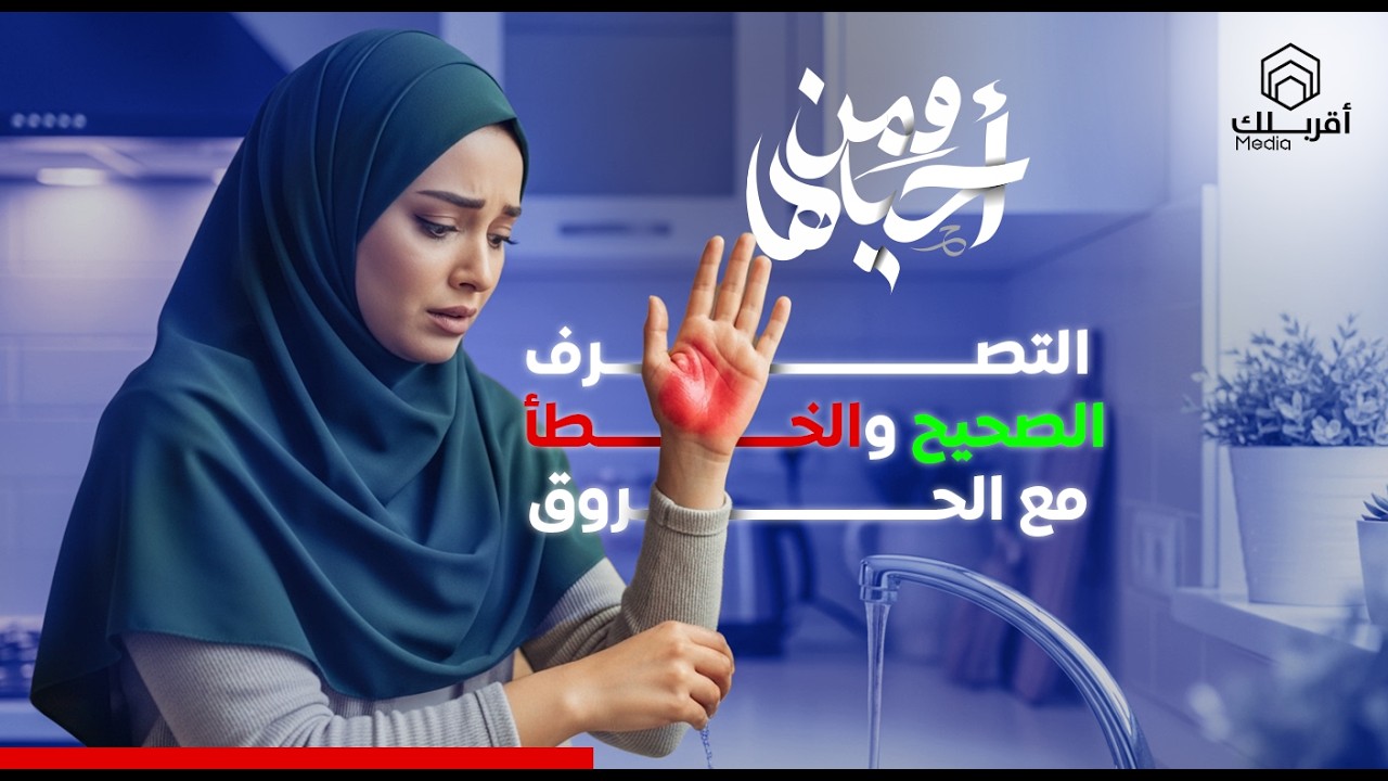 3 دقايق بعد الحرق… يا تنقذ الجلد يا تدمّره!