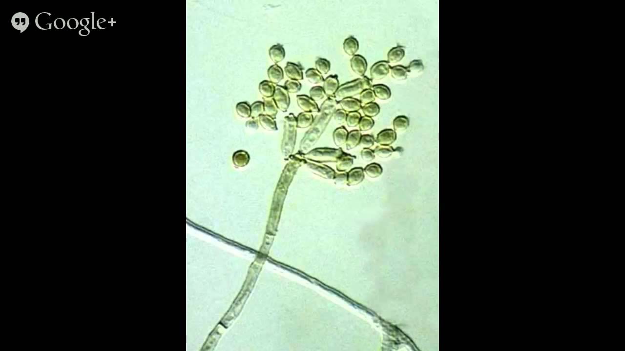 Fairbairn Inspection Services &ndash; Why is there Mold on my Windows?