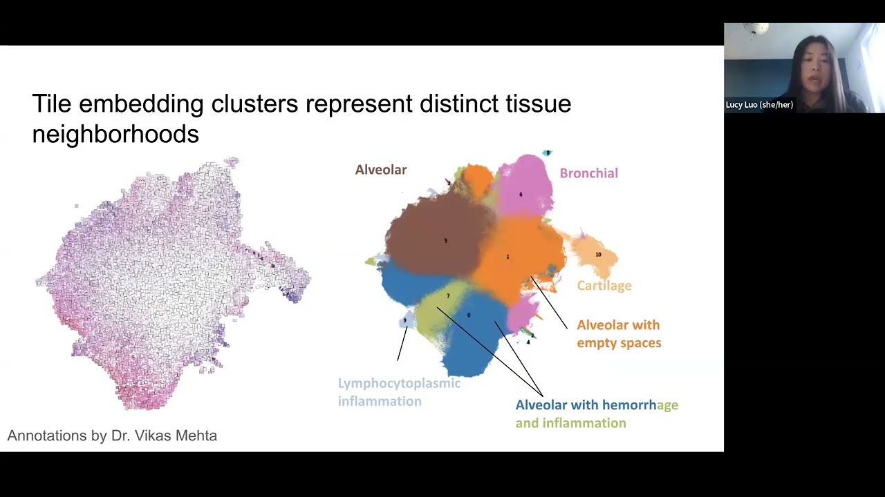 Midwest Bioinformatics Showcase Seminar Series. Session 1 Speaker: Lucy Luo, Northwestern University
