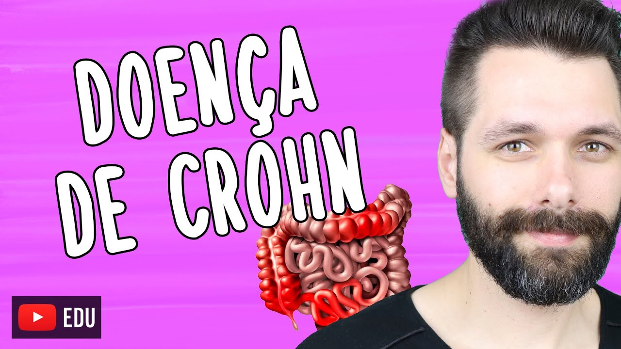 DOENÇA DE CROHN - O que é, sintomas e cuidados | Biologia com Samuel Cunha