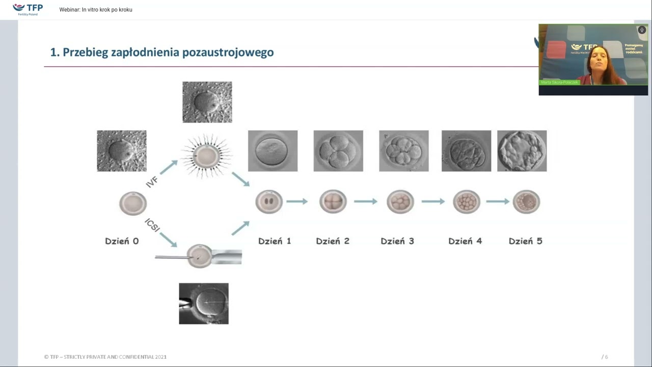 In vitro krok po kroku. Wszystko, co musisz wiedzieć o IVF | TFP Fertility Polska