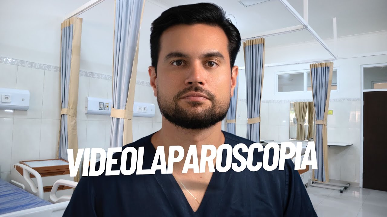 Benefícios da videolaparoscopia!