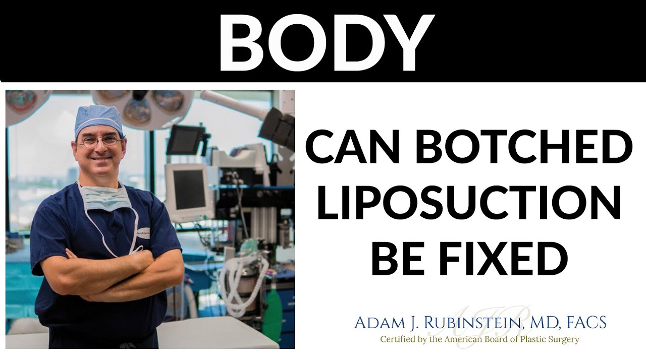 Plastic Surgery Truths - CAN BAD LIPOSUCTION GET FIXED?