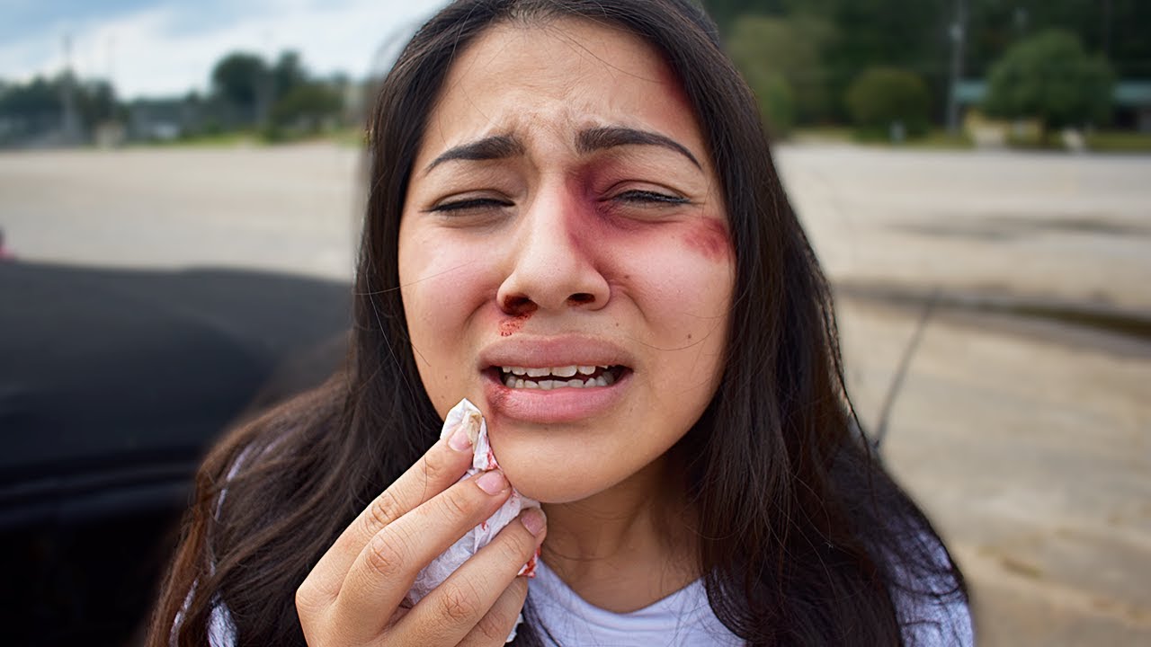 I Got Beat Up Prank on Boyfriend! Jehiely N Alex