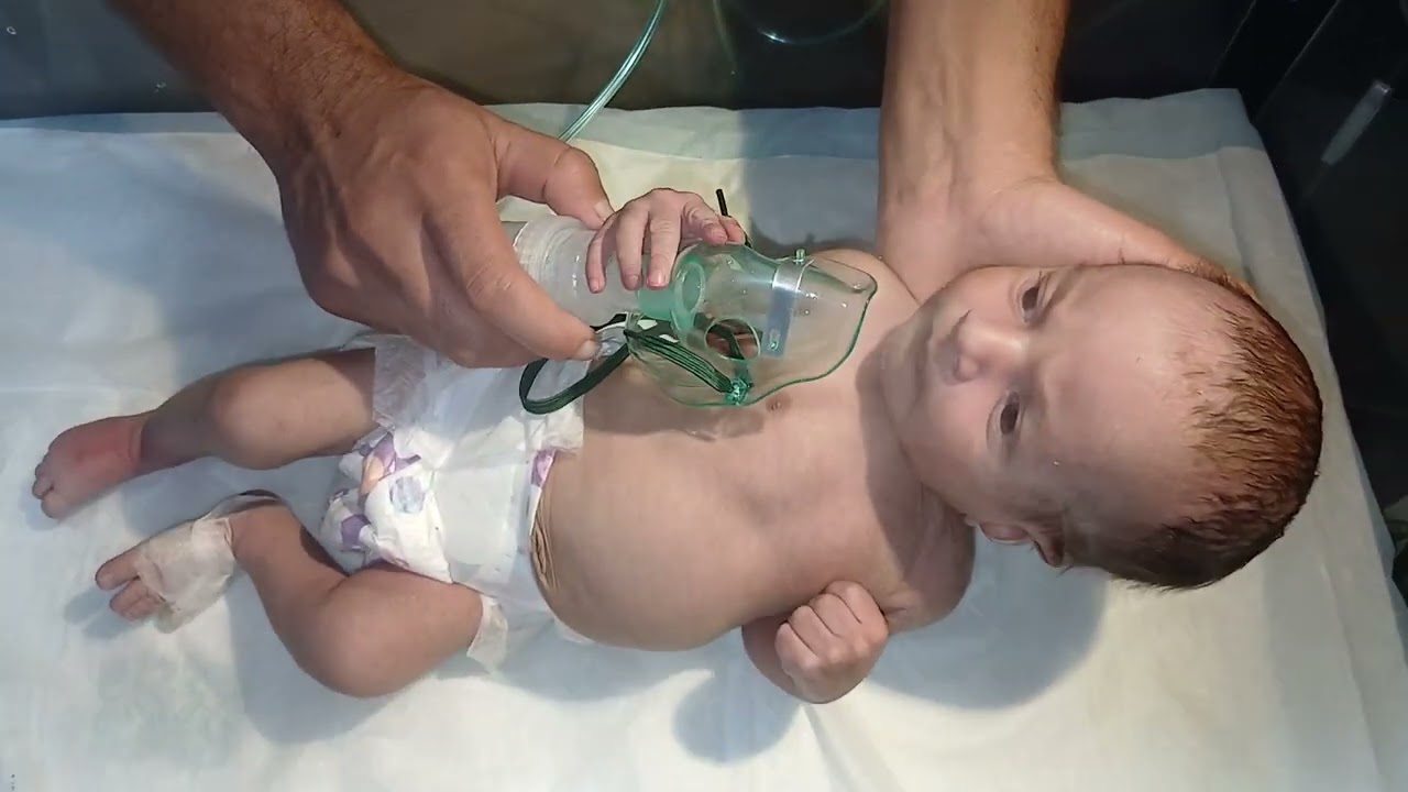 Cute Baby Chest 🫁 Infection | Nebulization Therapy Protocol & Management