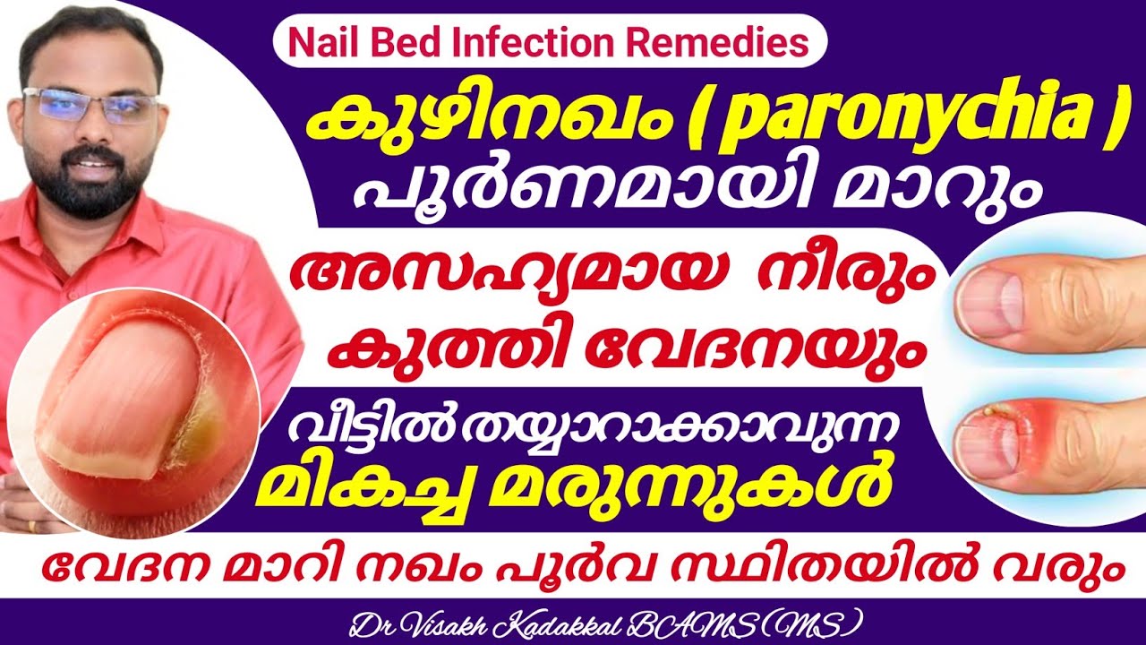 കുഴിനഖം | Kuzhinagam | Toenail infection | Dr Visakh Kadakkal