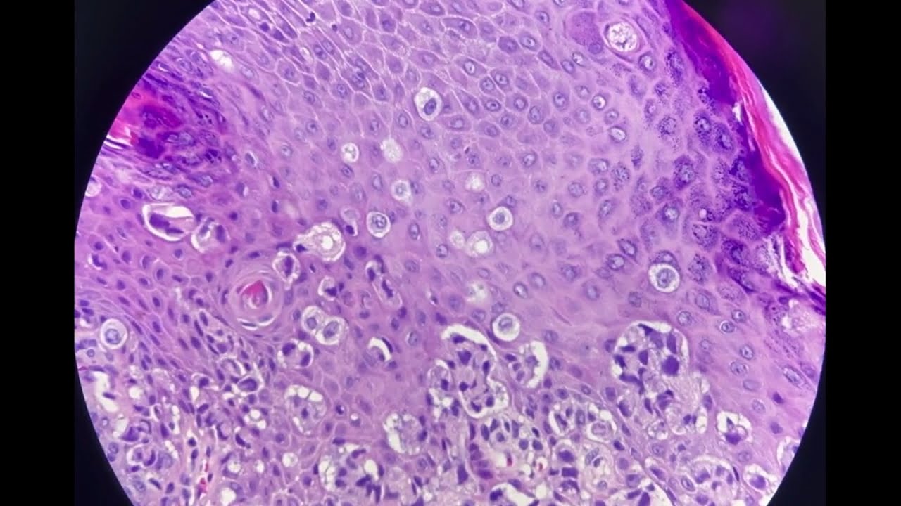 Caso 16 | Pathologists Online