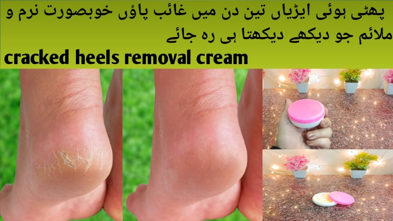Beautiful soft feet cracked heels removal cream|homemade cream for dry cracked heels