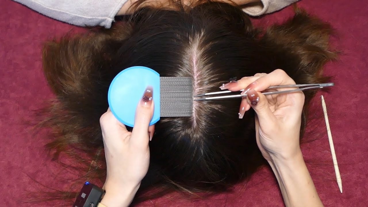 ASMR School Nurse LICE Check & Nitpicking with NAILS | Removal with Tweezers (Real Person)