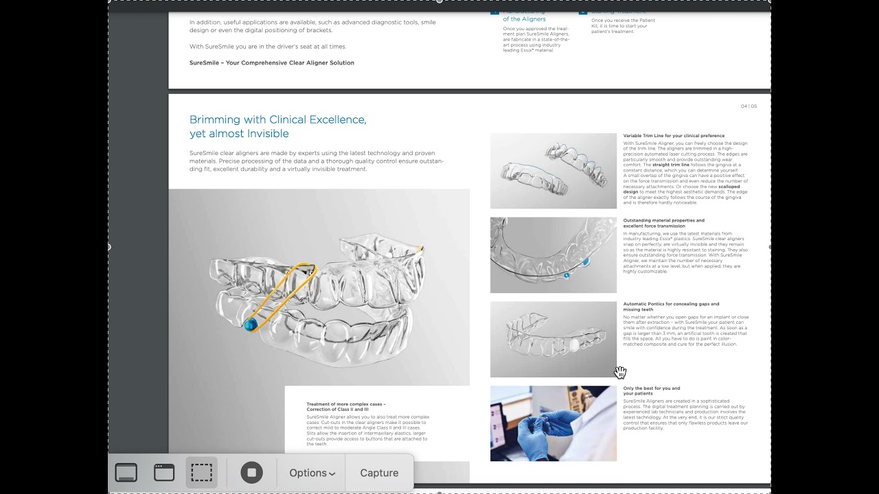 Should You Offer SureSmile Aligners?