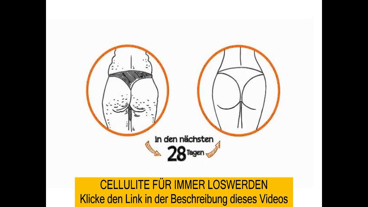 cellulite workout pinterest - bester Weg um Cellulite loszuwerden