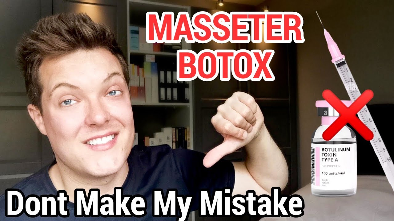 My MASSETER BOTOX Nightmare -  Dont Make The Same Mistakes