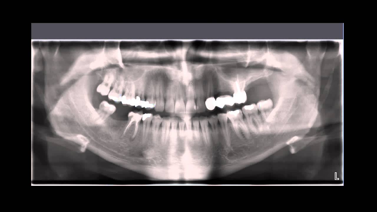 Was passiert beim Ersttermin bei Denta Beaute