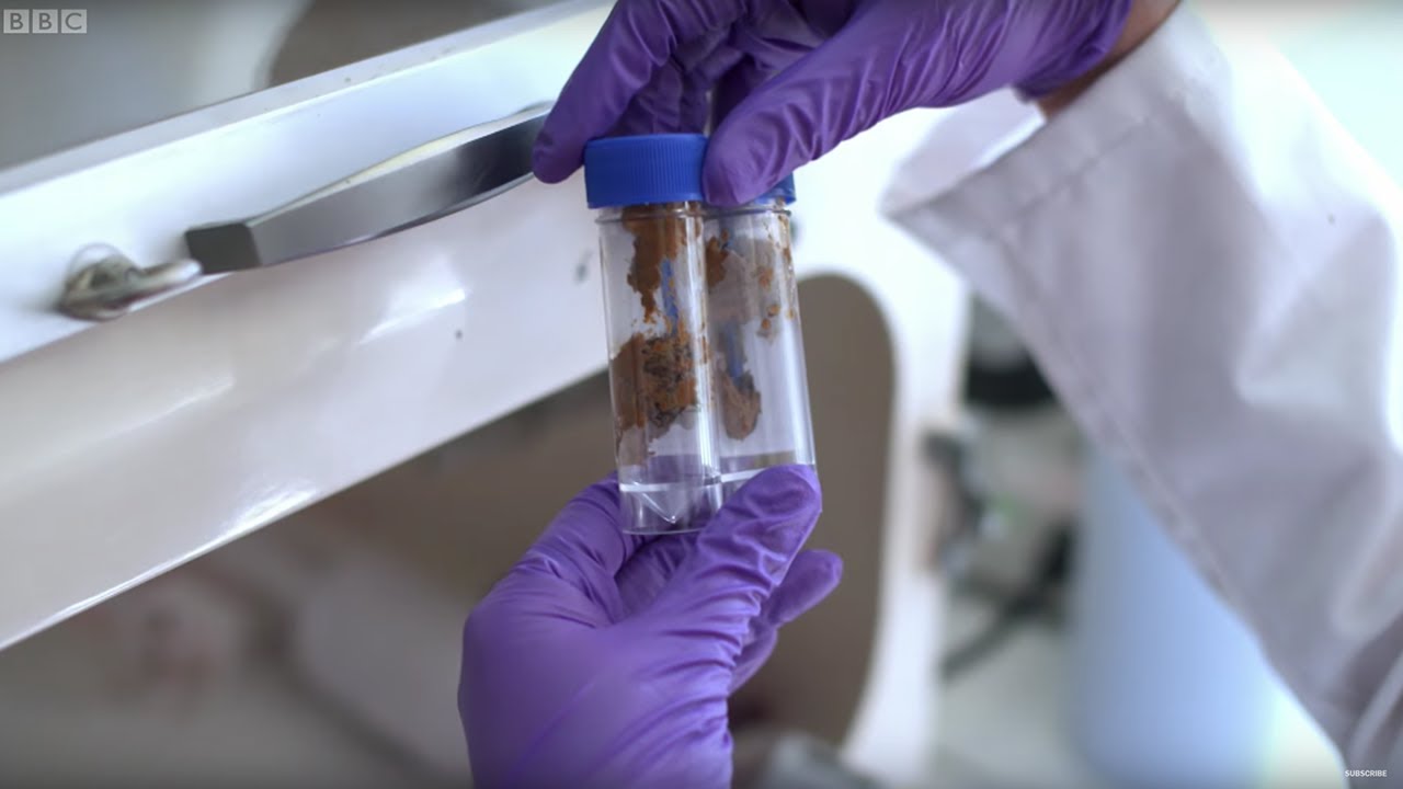 Getting A POOP TRANSPLANT | Earth Science