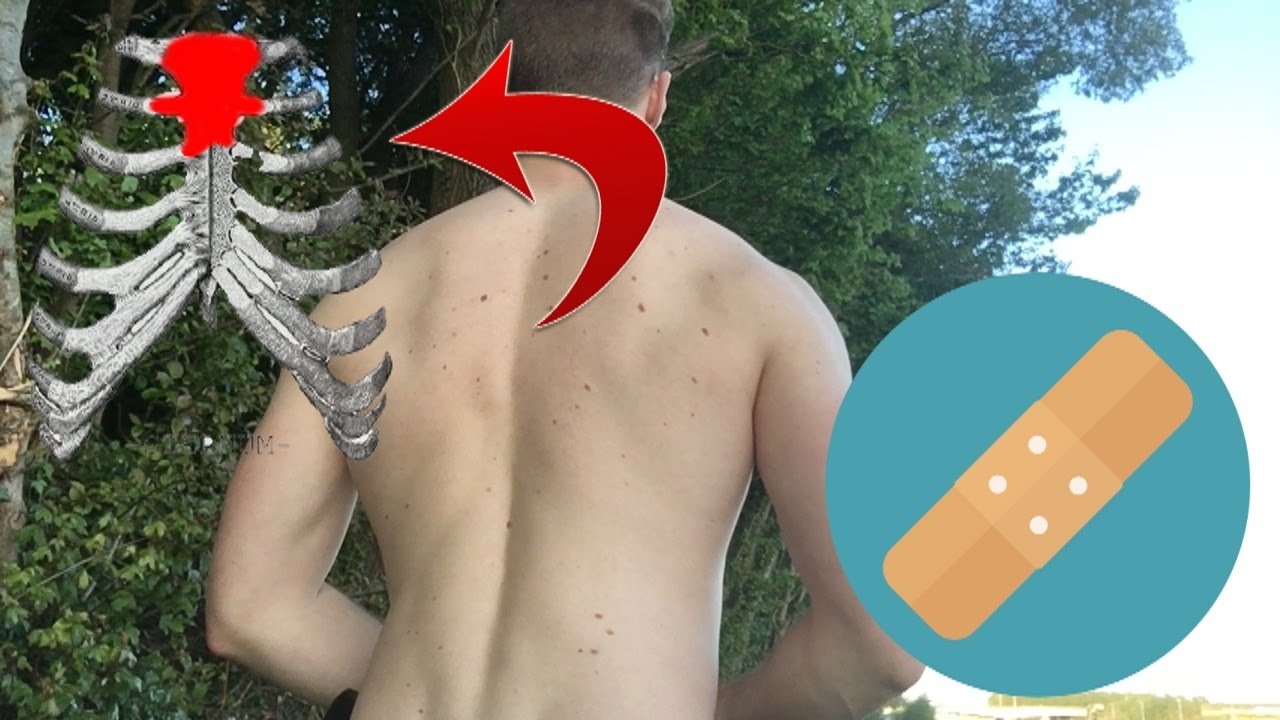 Fixing your Sternum: Increase Thoracic spine Mobility.