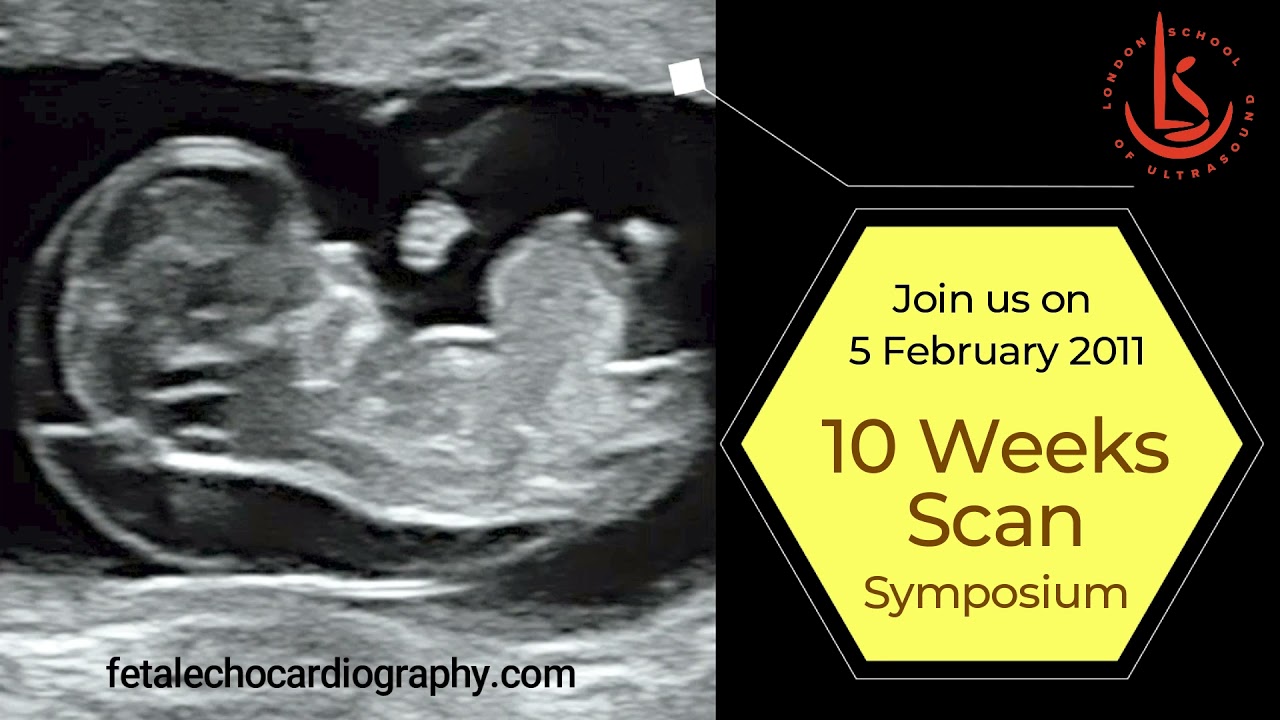 10 Weeks Scan Symposium 2022