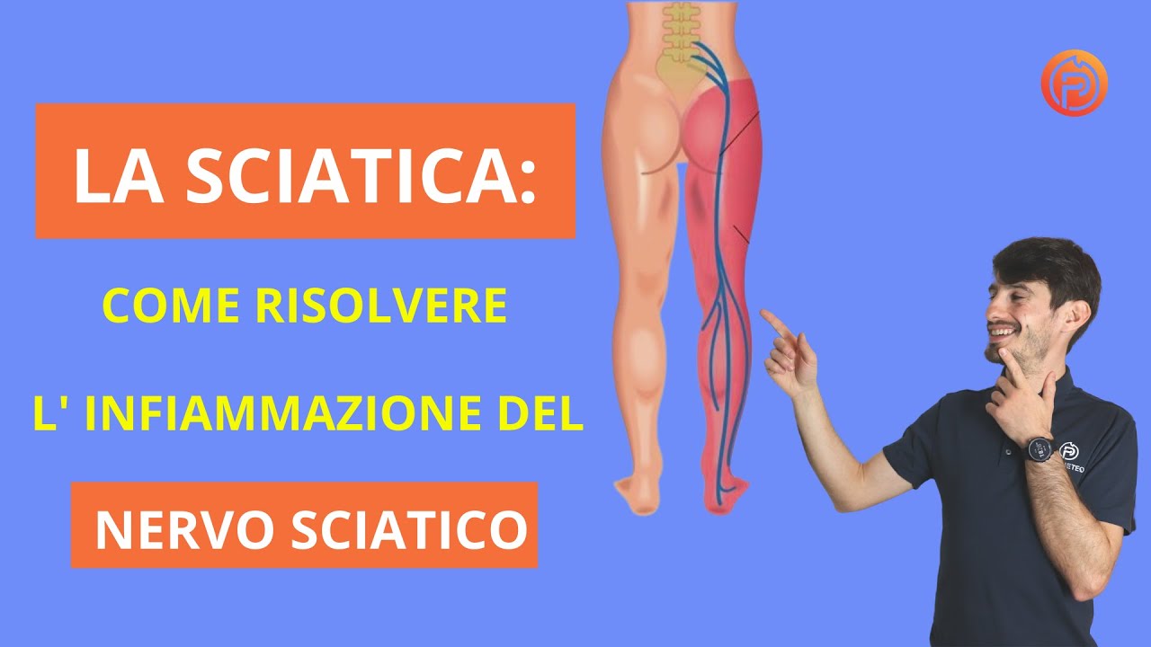 La SCIATICA. Infiammazione del nervo sciatico. Come trattarla. (2022)
