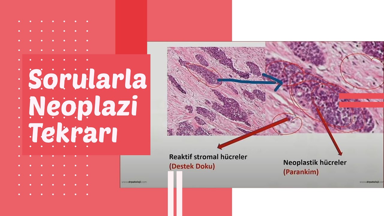 Sorularla 
