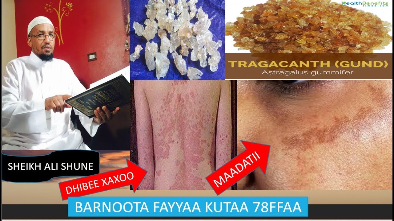 BARNOOTA FAYYAA KUTAA 78FFAA HABAKHAT