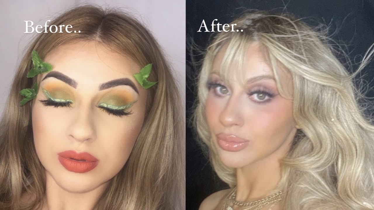 I GOT MY BUCCAL FAT REMOVAL DONE IN MEXICO- full update+ regrets