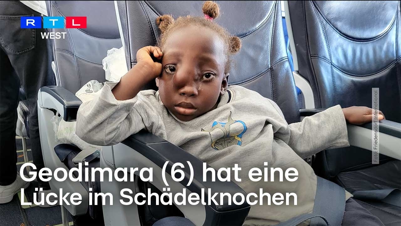 Lücke im Schädel – Geodimara (6) aus Angola bekommt aufwendige Operation in NRW | RTL WEST