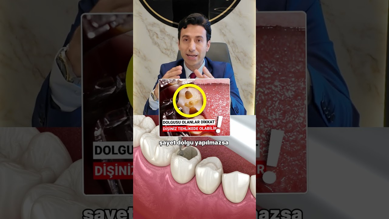 DİŞİNİZE DOLGU YAPTIRMAZSANIZ NE OLUR ? #dişdolgusu #ismailg&uuml;le&ccedil; #dolgutedavisi