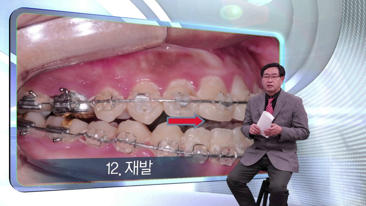 김재승교수의 양악수술
