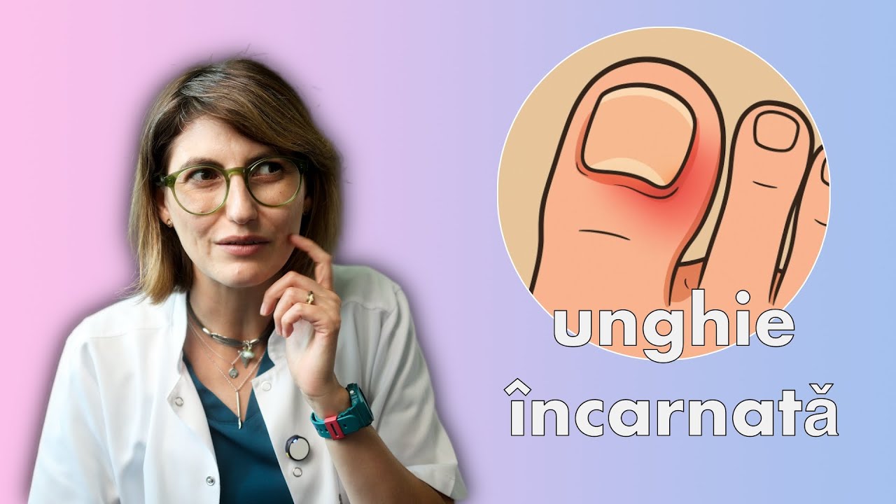 ce facem cu unghia incarnata de la picior?