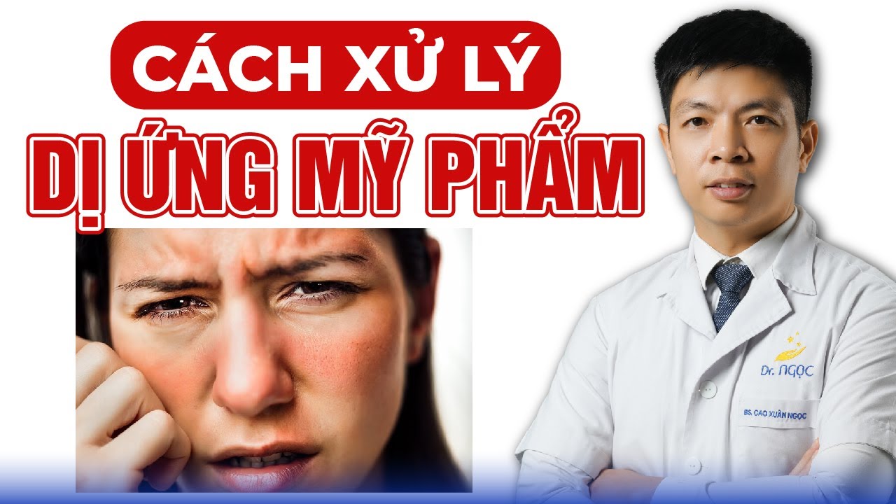 C&aacute;ch Xử L&yacute; Khi Bị Dị Ứng Mỹ Phẩm | Dr Ngọc