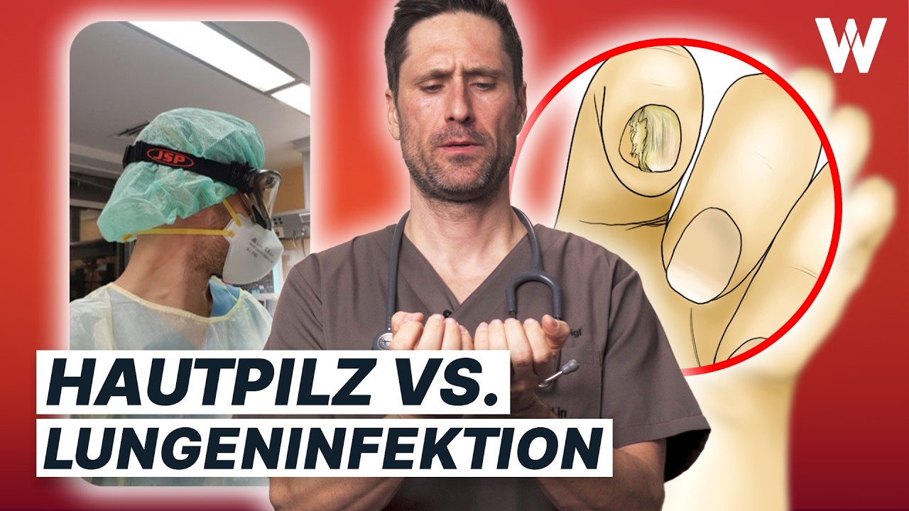 Pilzinfektionen: Enormes Problem und total unterschätzt! Das solltest Du ab jetzt wissen
