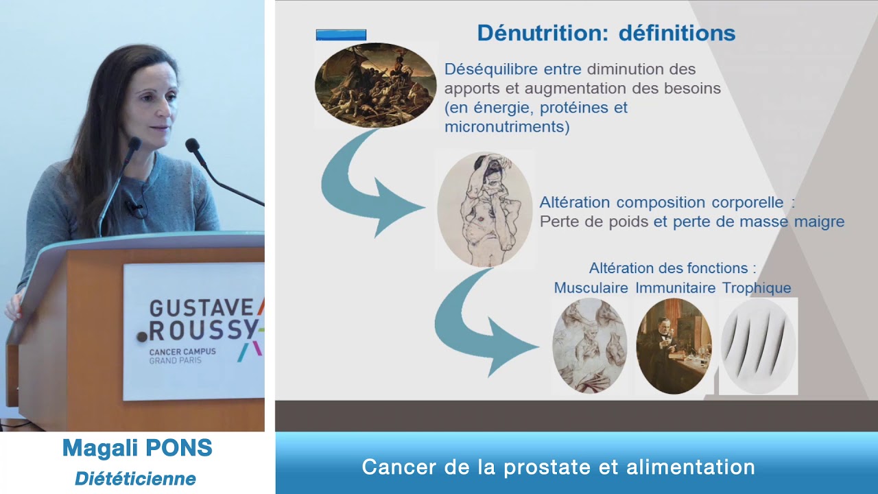 Cancer de la prostate et alimentation avec le Dr Bruno RAYNARD, Nutritionniste  et Mme Magali PONS,